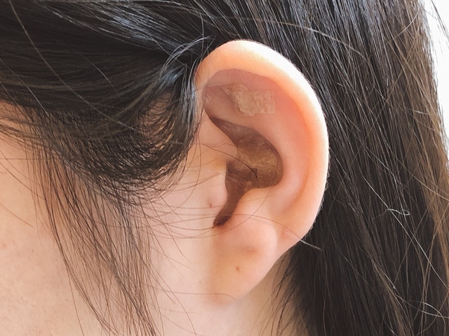 耳つぼダイエットで余分な脂肪を落として綺麗に痩せるト決意した20代女性.JPG